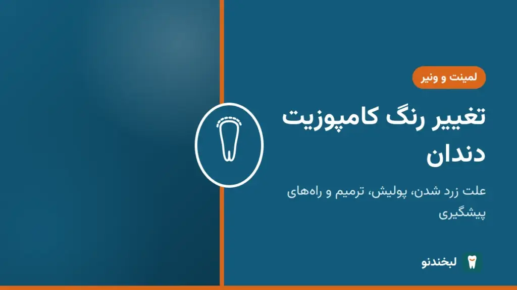 لمینت و ونیر: تغییر رنگ کامپوزیت دندان؛ علت زرد شدن، پولیش، ترمیم و راههای پیشگیری