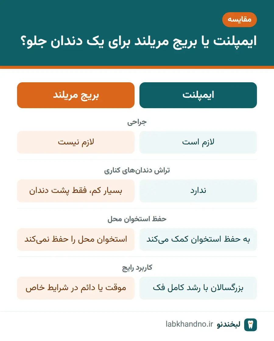 مقایسه ایمپلنت دندان جلو با بریج مریلند