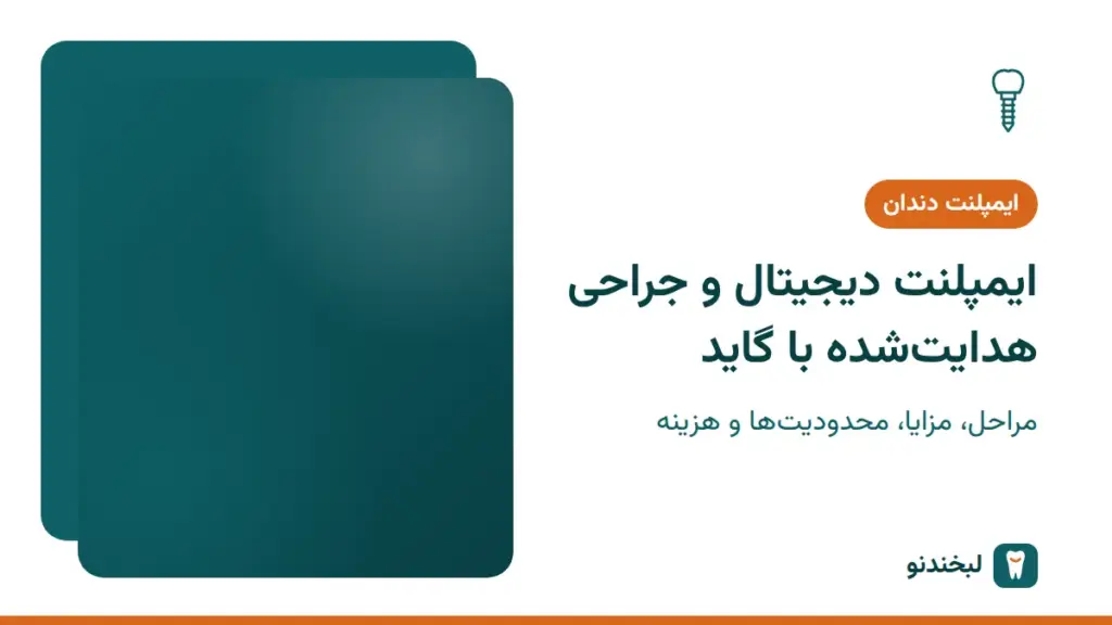 ایمپلنت دندان: ایمپلنت دیجیتال و جراحی هدایتشده با گاید؛ مراحل، مزایا، محدودیتها و هزینه