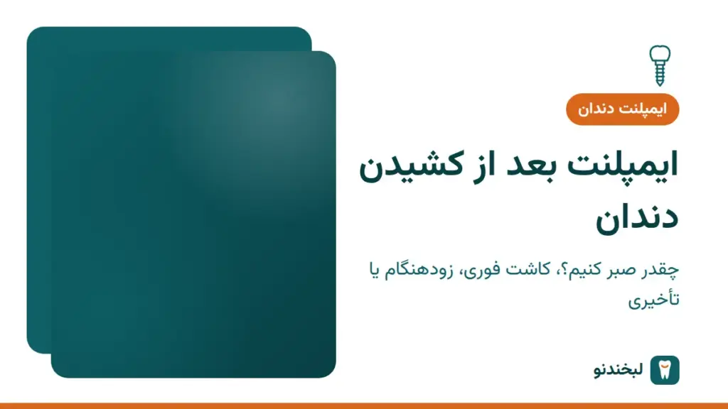 ایمپلنت دندان: ایمپلنت بعد از کشیدن دندان؛ چقدر صبر کنیم؟ کاشت فوری، زودهنگام یا تأخیری
