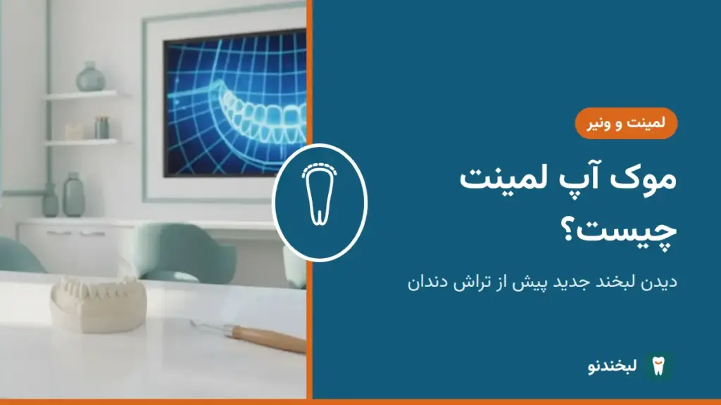 لمینت و ونیر: موک آپ لمینت چیست؟ دیدن لبخند جدید پیش از تراش دندان