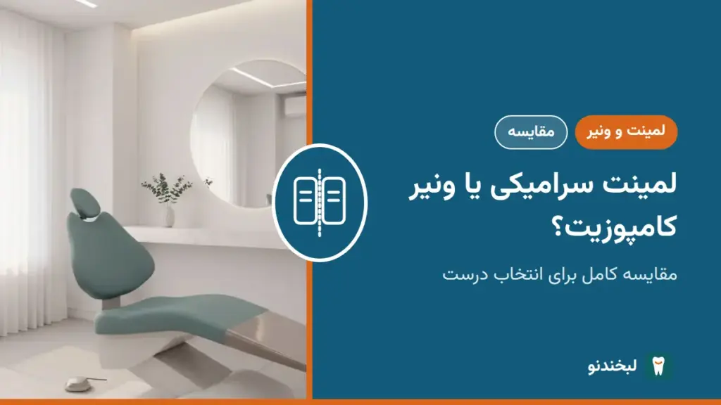 لمینت و ونیر: لمینت سرامیکی یا ونیر کامپوزیت؟ مقایسه کامل برای انتخاب درست