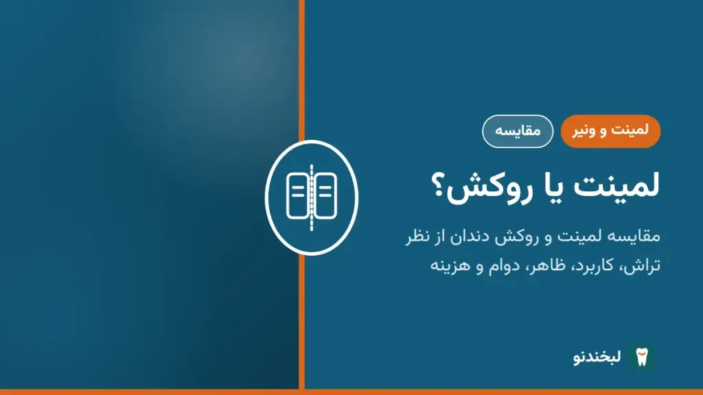 لمینت و ونیر: لمینت یا روکش؟ مقایسه لمینت و روکش دندان از نظر تراش، کاربرد، ظاهر، دوام و هزینه