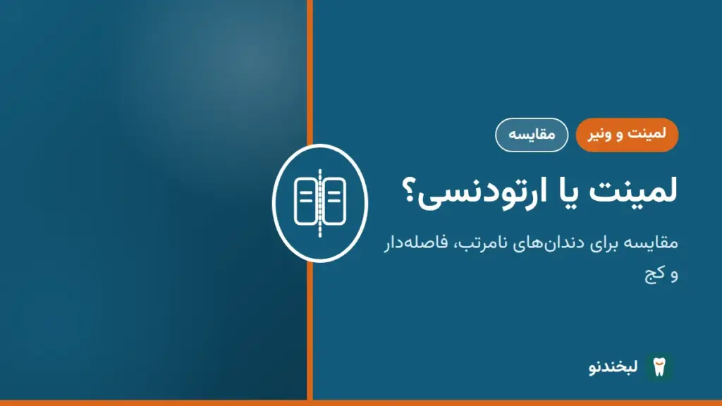 لمینت و ونیر: لمینت یا ارتودنسی؟ مقایسه برای دندانهای نامرتب، فاصلهدار و کج