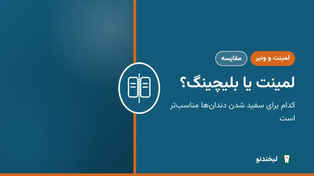 لمینت و ونیر: لمینت یا بلیچینگ؟ کدام برای سفید شدن دندانها مناسبتر است