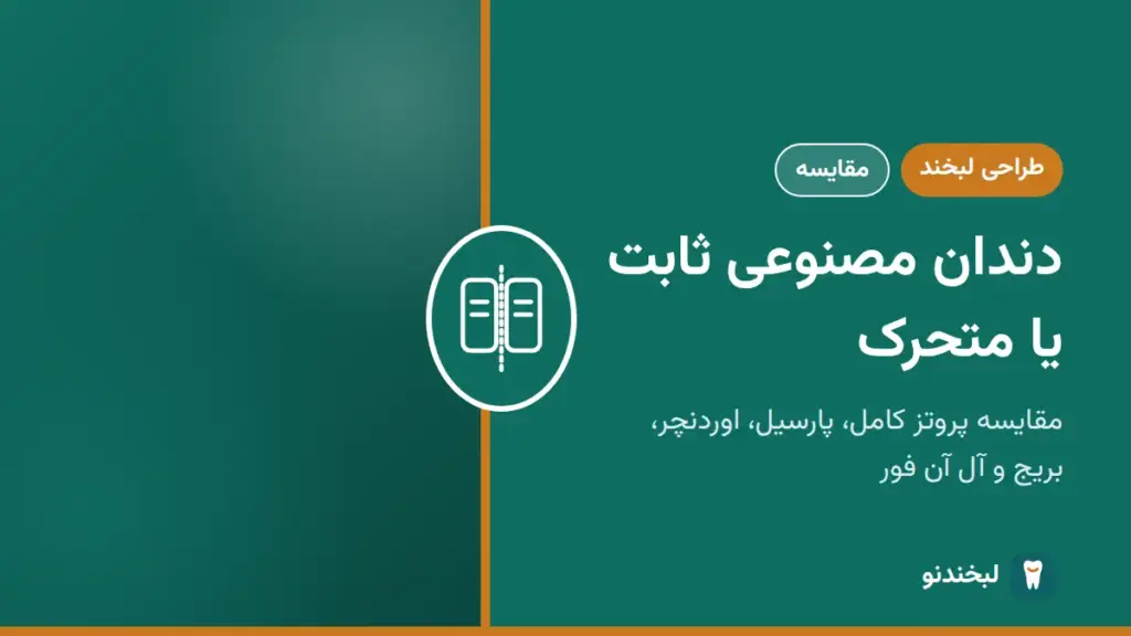 طراحی لبخند: دندان مصنوعی ثابت یا متحرک؛ مقایسه پروتز کامل، پارسیل، اوردنچر، بریج و آل آن فور