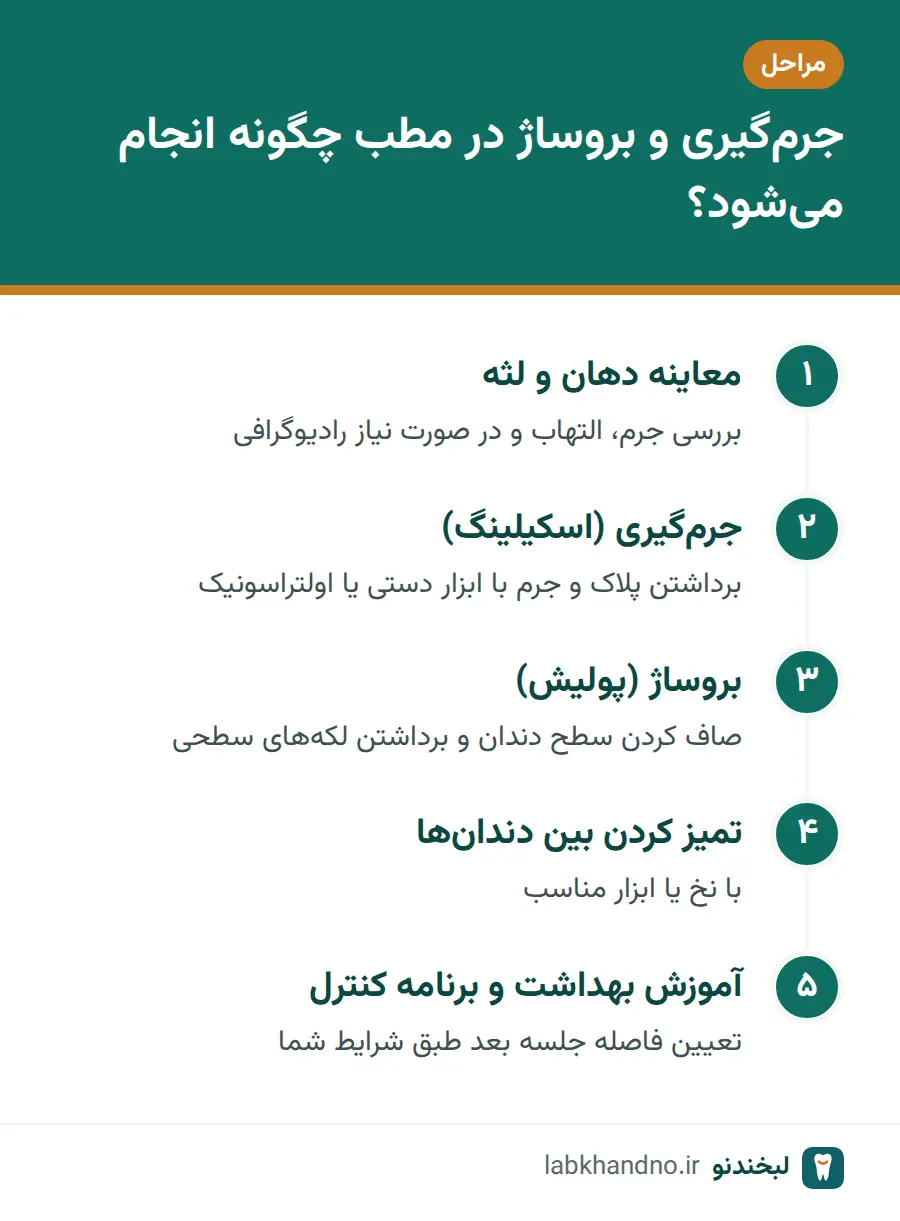 مراحل جرم‌گیری و بروساژ دندان در مطب