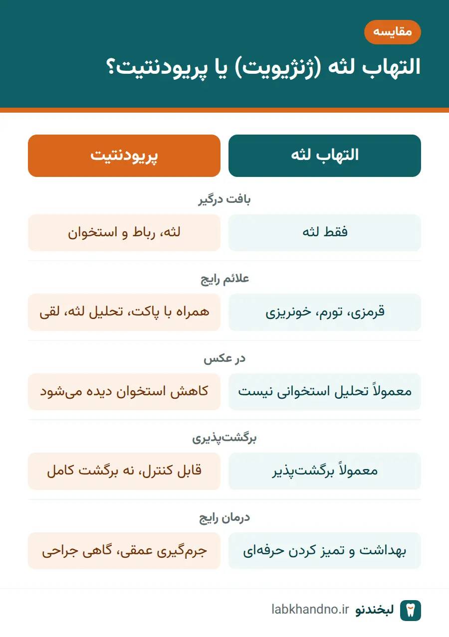 مقایسه التهاب لثه و پریودنتیت به‌عنوان دو مرحله بیماری لثه