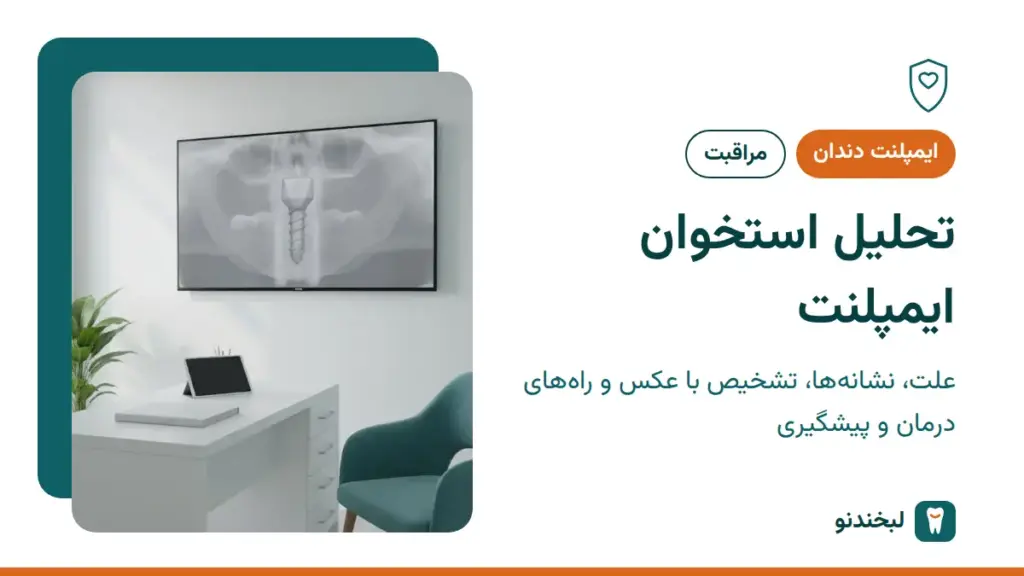 ایمپلنت دندان: تحلیل استخوان ایمپلنت؛ علت، نشانهها، تشخیص با عکس و راههای درمان و پیشگیری