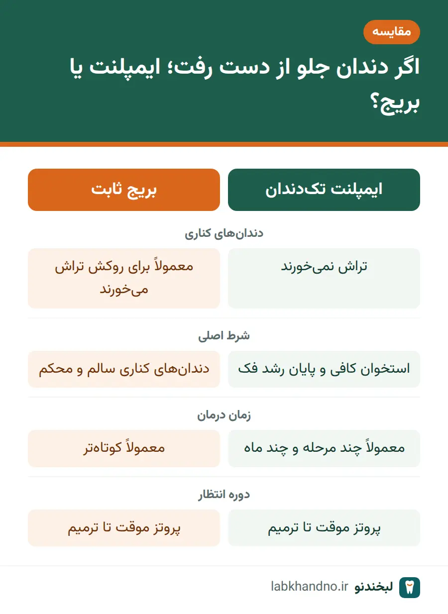 مقایسه ایمپلنت و بریج برای جایگزینی دندان جلو پس از افتادن دندان در اثر ضربه
