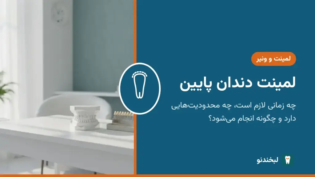 لمینت و ونیر: لمینت دندان پایین؛ چه زمانی لازم است، چه محدودیتهایی دارد و چگونه انجام میشود؟