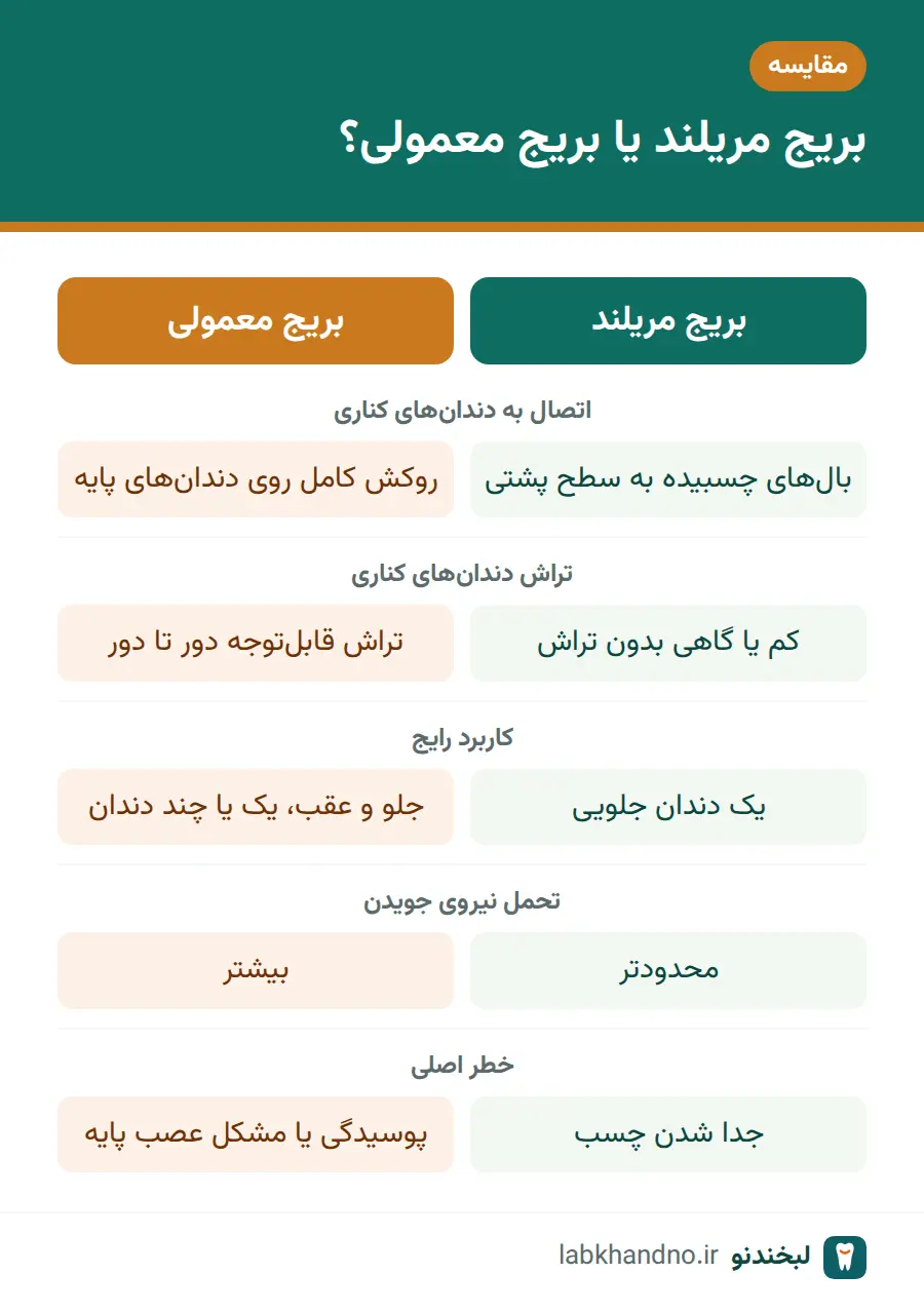 مقایسه بریج مریلند و بریج معمولی از نظر تراش، کاربرد و نیروی جویدن