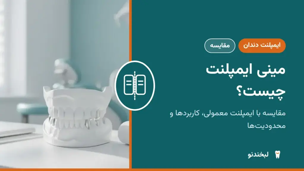 ایمپلنت دندان: مینی ایمپلنت چیست؟ مقایسه با ایمپلنت معمولی، کاربردها و محدودیتها