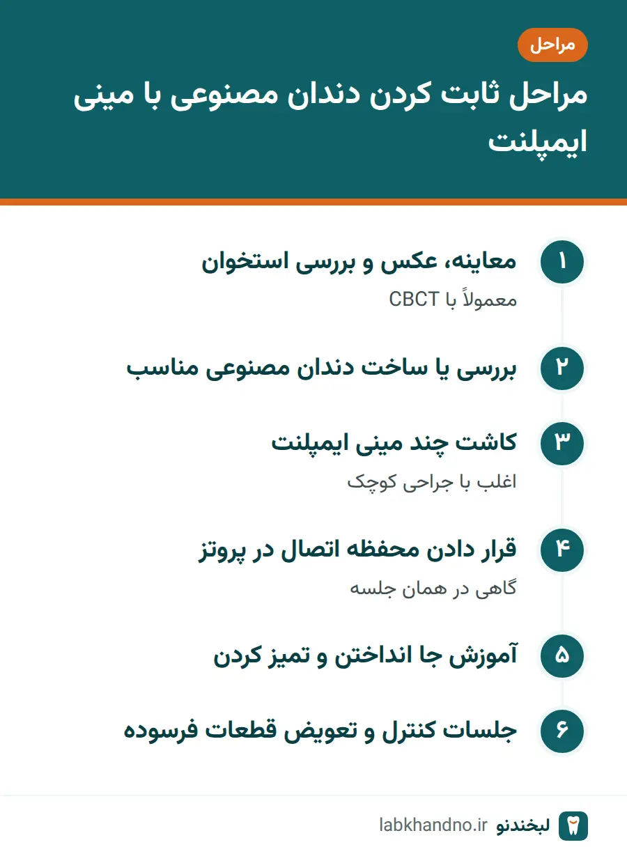 مراحل ثابت کردن دندان مصنوعی با مینی ایمپلنت از معاینه تا کنترل