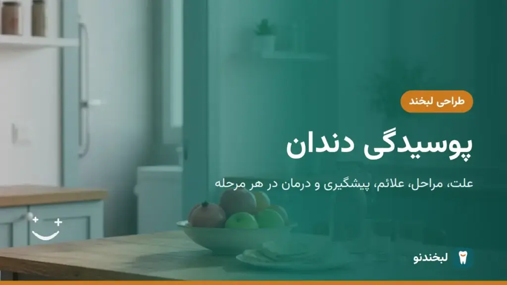 طراحی لبخند: پوسیدگی دندان؛ علت، مراحل، علائم، پیشگیری و درمان در هر مرحله
