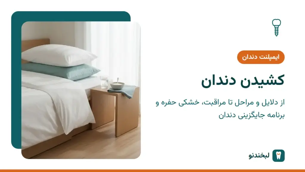 ایمپلنت دندان: کشیدن دندان؛ از دلایل و مراحل تا مراقبت، خشکی حفره و برنامه جایگزینی دندان